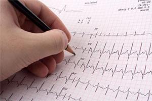 EKG: norma podstawowych wskaźników